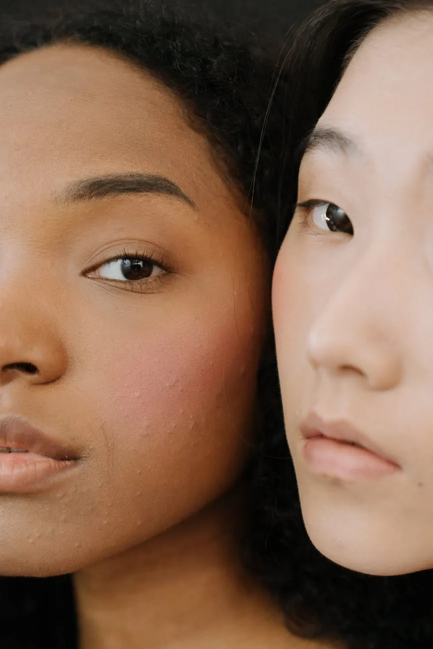 What Is Microneedling And How Does It Work? 10 woman with black hair and black eyes