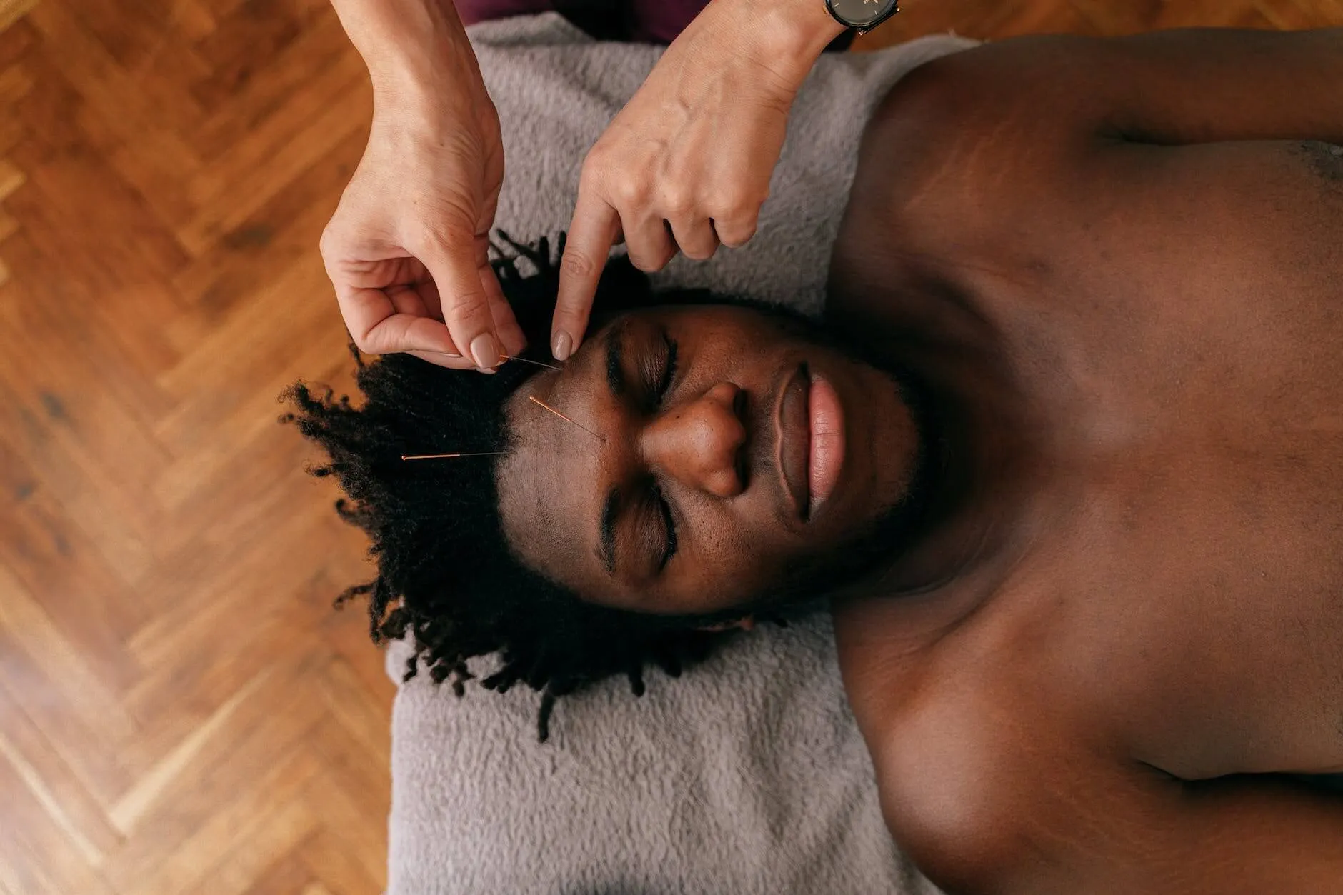 What Is Microneedling And How Does It Work? 12 person putting needles on the forehead of a man