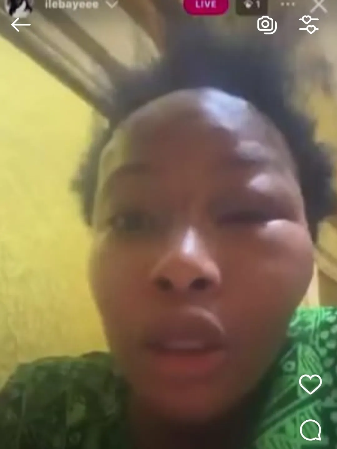 Ilebaye face after Being Assaulted in Her Home